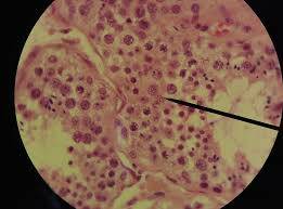 images (1)