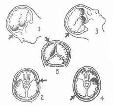 u=2554967233,402448700&fm=21&gp=0