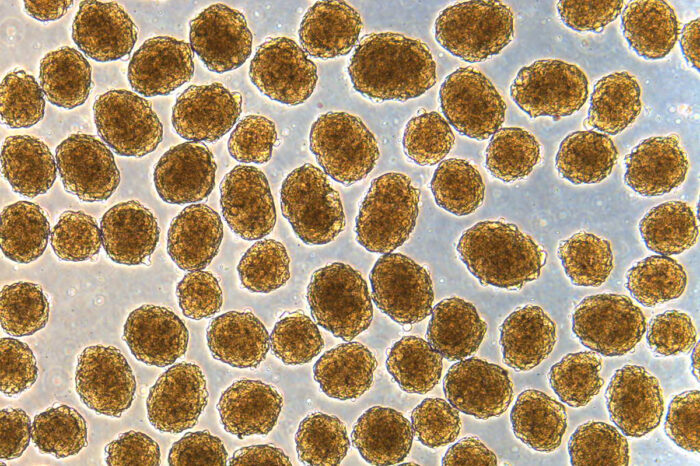 显微镜下可以产生人类胰岛素的β细胞