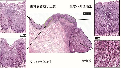 全球湖泊水生植被加剧退化 | 中国一周科技速览 #170917